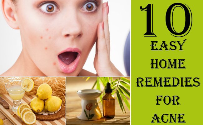 Ways to clear acne fast home remedies