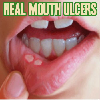 How To Heal Cuts In Mouth 23