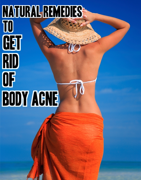Natural Remedies To Get Rid Of Body Acne