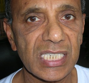 Sheetkari Pranayama