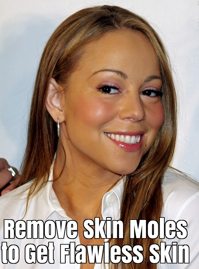 How to Remove Skin Moles to Get Flawless Skin?