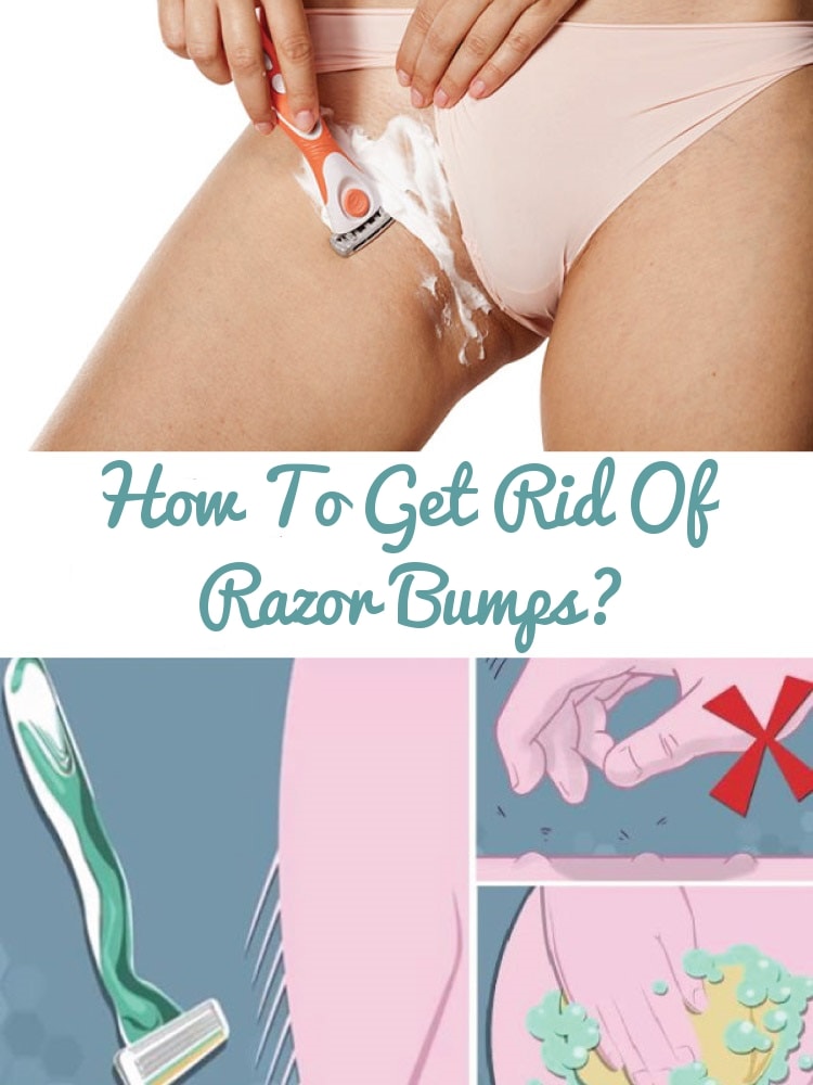 How to Get Rid of Razor Bumps in Bikini Area?