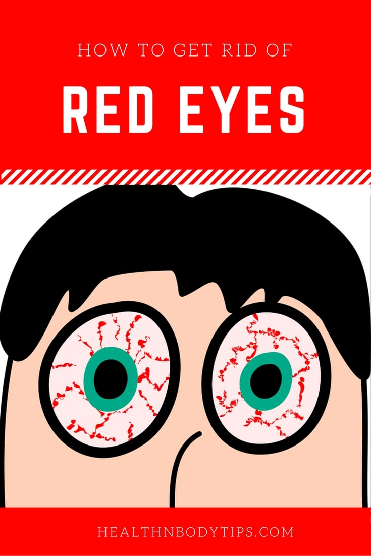 How to Get Rid of Red Eyes / Bloodshot Eyes?