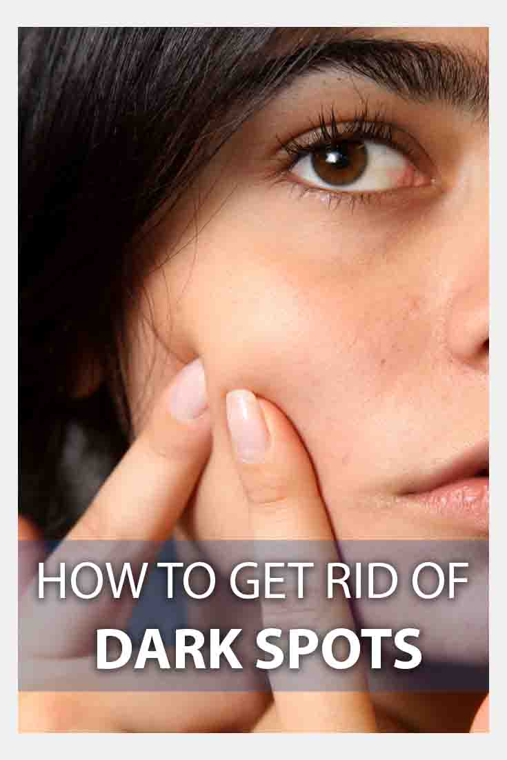 how to get rid of dark spots on skin home remedies to get rid of dark 