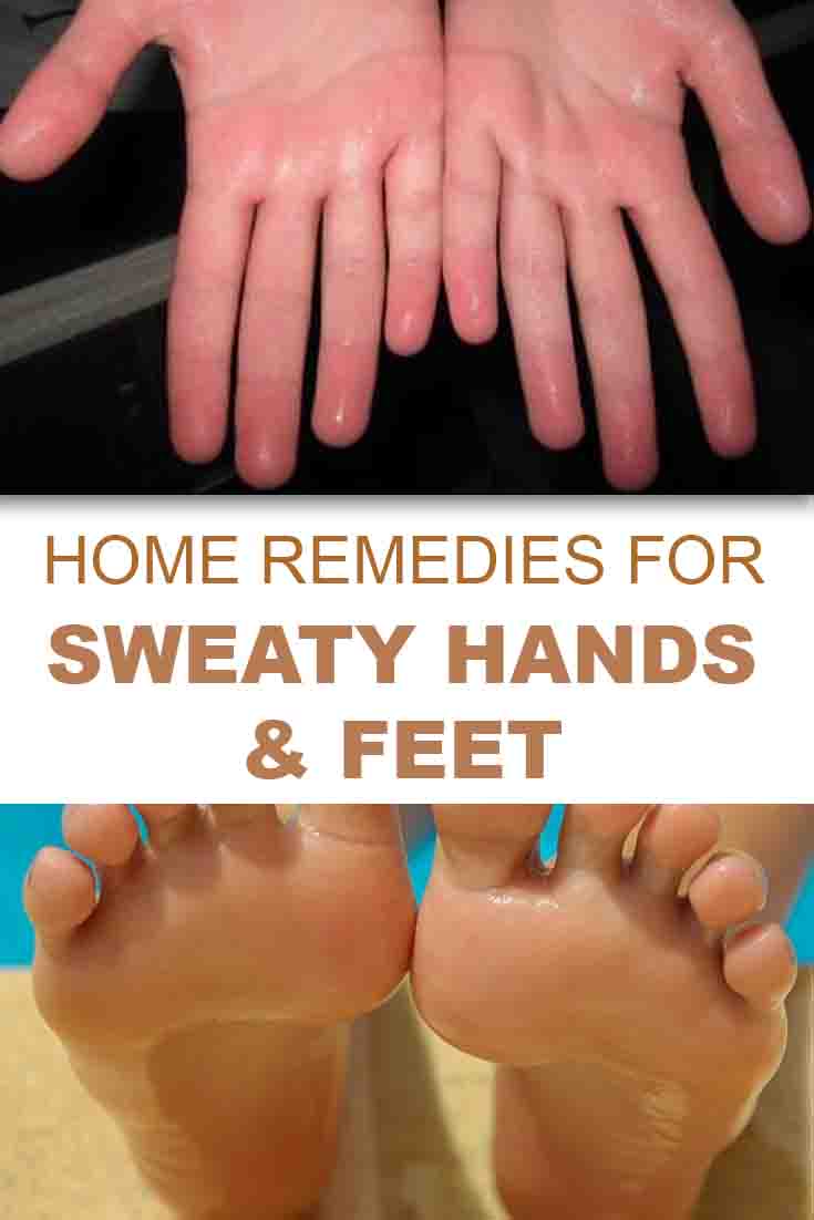 What are some simple cures for sweaty palms?